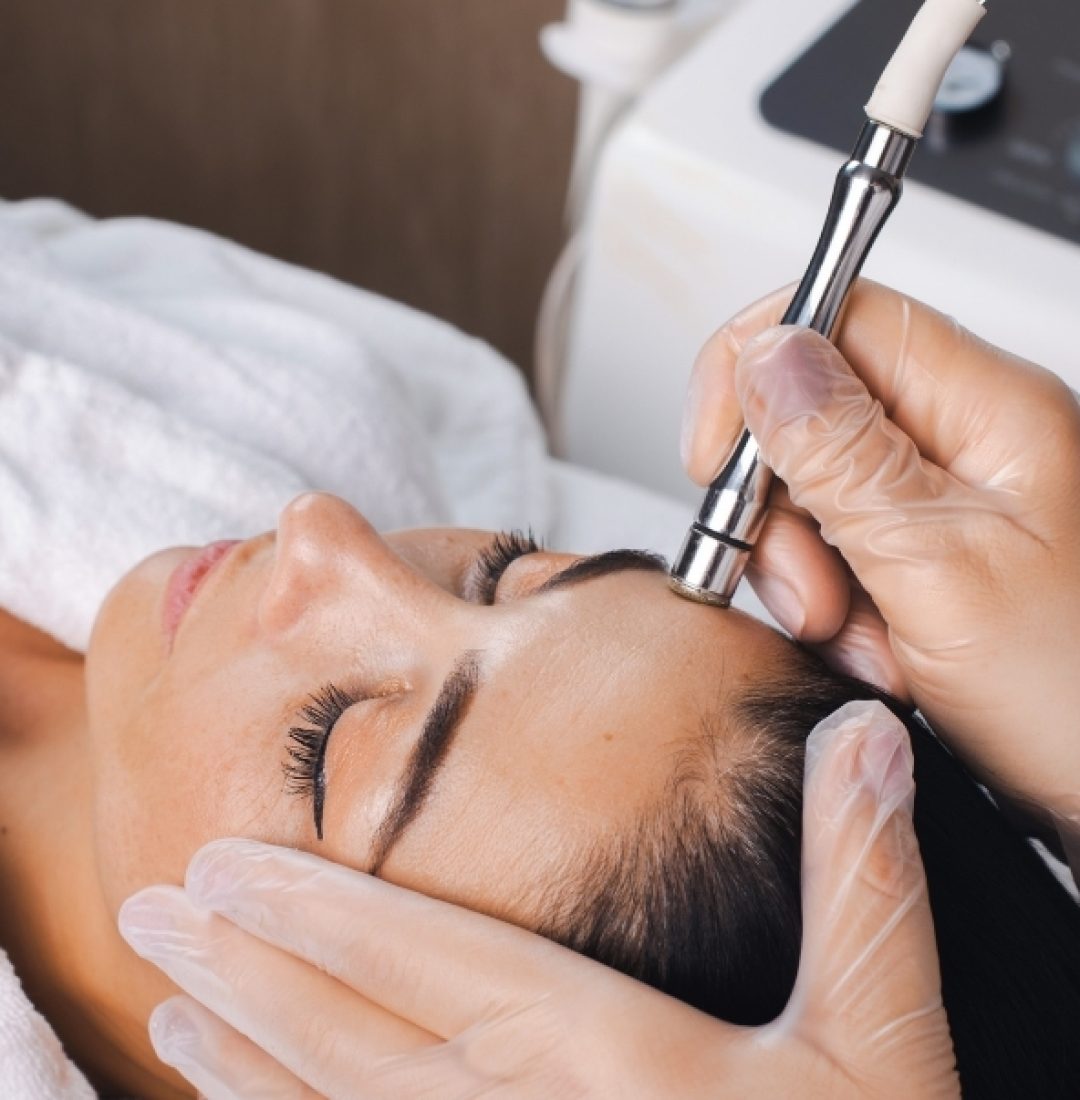 Microdermabrasion